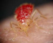 bedbugsbites.jpg